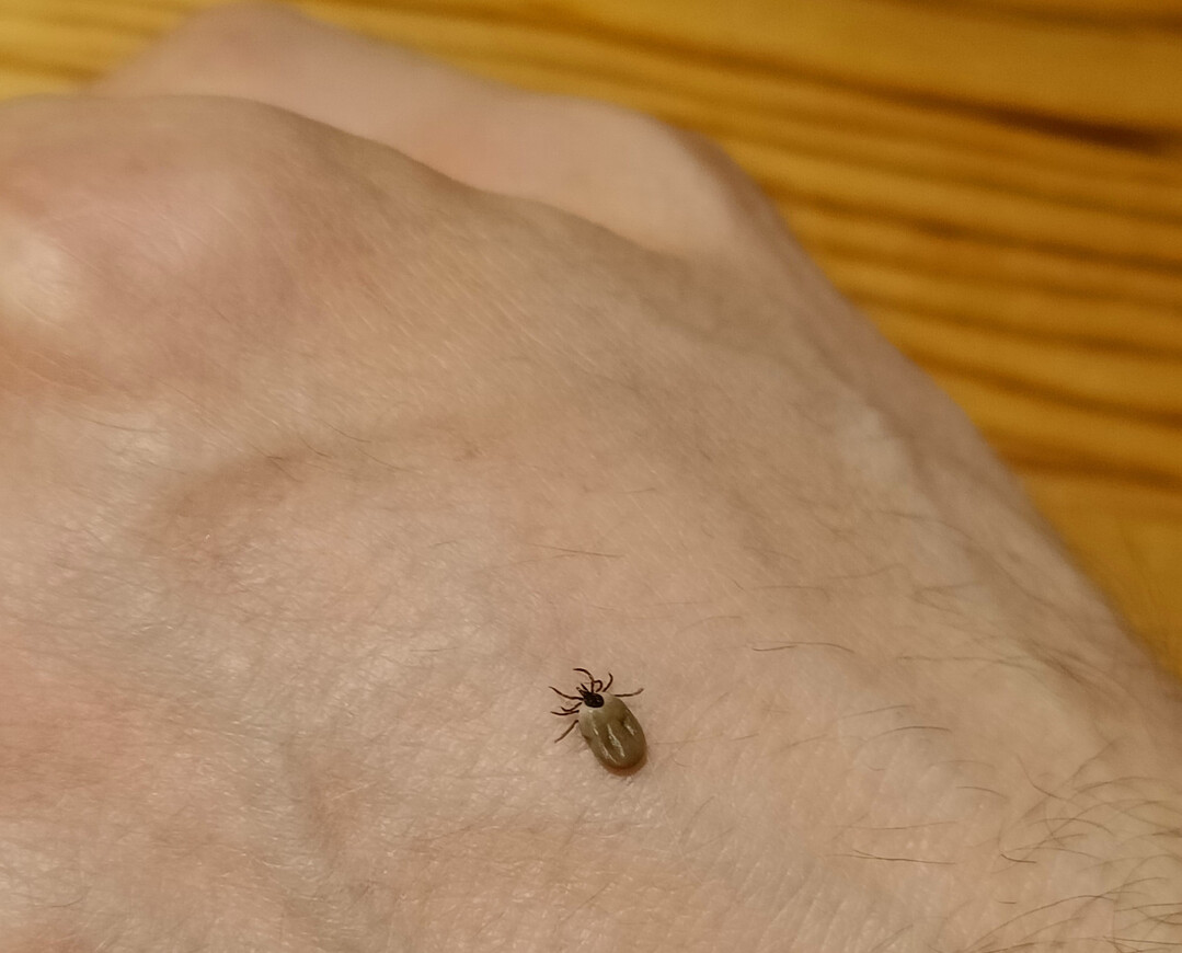 In den Risikogebieten liegt die Wahrscheinlichkeit einer FSME-Infektion nach einem Zeckenstich bei 1:50 bis 1:100. 
