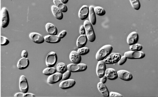 Saccharomyces cerevisiae wird bei der Herstellung von alkoholischen Getrnken eingesetzt. 